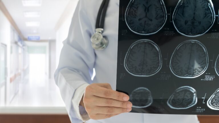 Doctor check up x-ray film of the brain